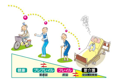 フレイルの説明